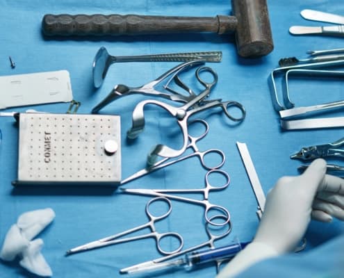 Parodontitis-Behandlung