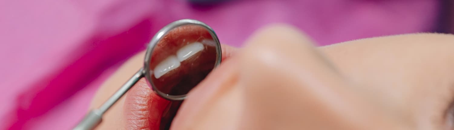 pexels-karolina-grabowska-6627483 Braune Flecken