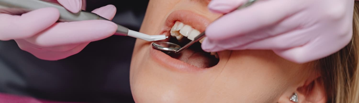 Zahnfleischtaschen – Bedrohung für die Zahnfleischgesundheit